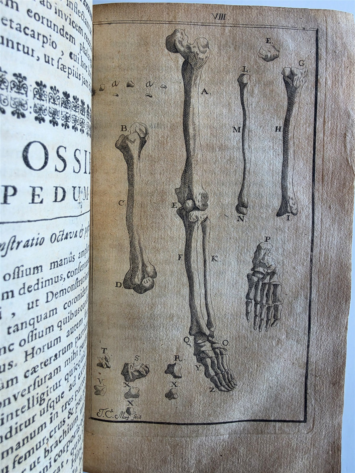 1696 ANATOMICAL TREATISE Anatomia Corporis Humani P.DIONIS antique ILLUSTRATED
