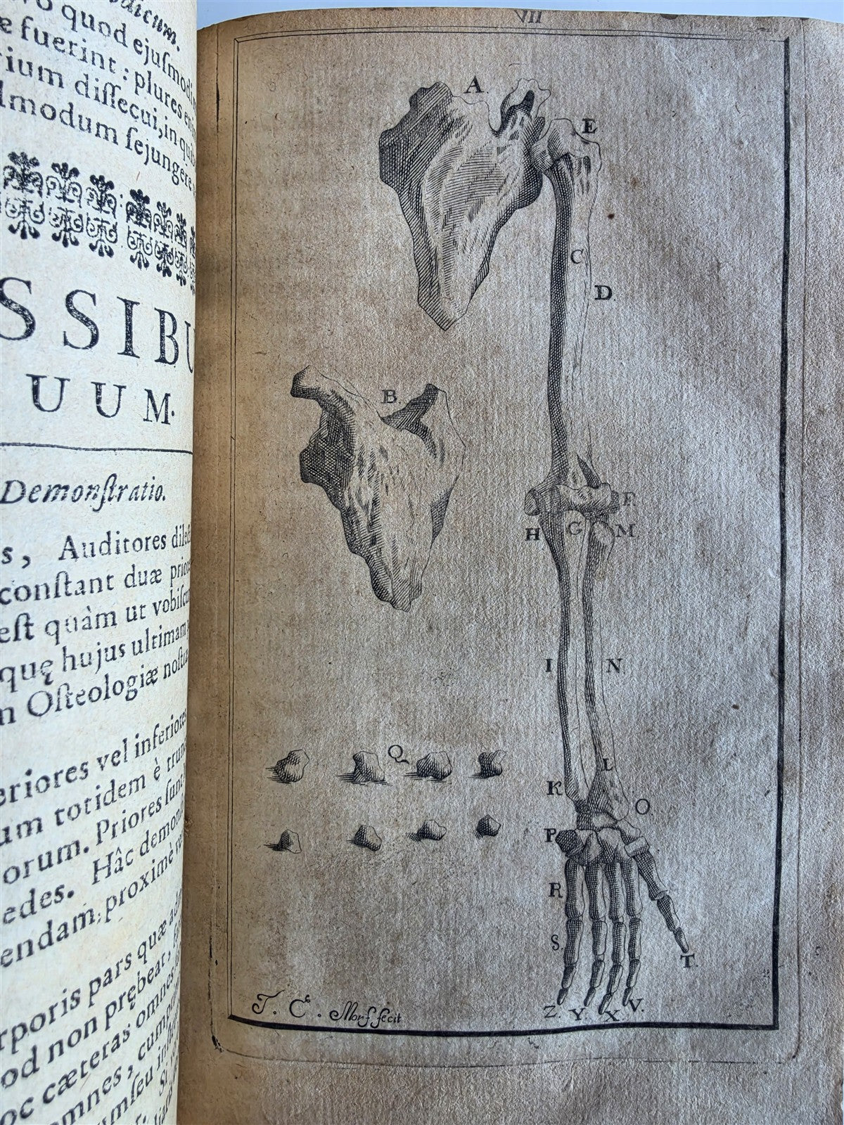 1696 ANATOMICAL TREATISE Anatomia Corporis Humani P.DIONIS antique ILLUSTRATED
