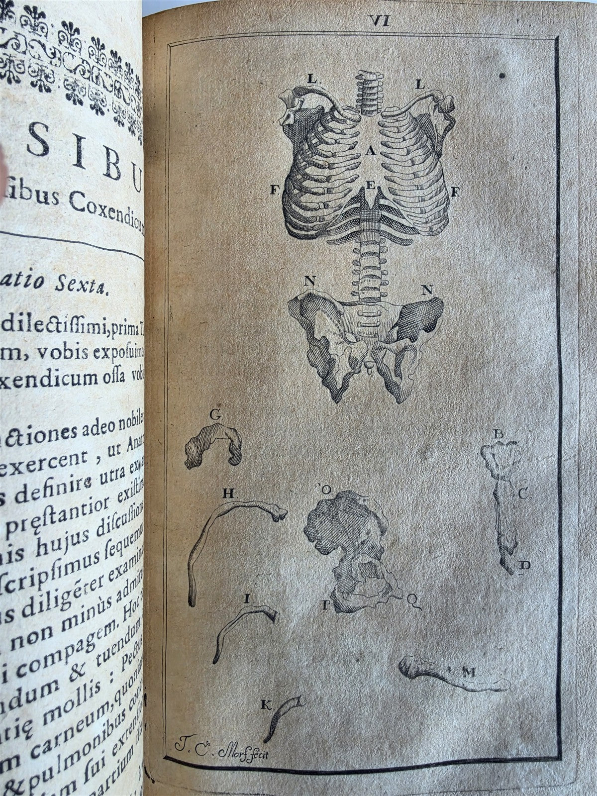 1696 ANATOMICAL TREATISE Anatomia Corporis Humani P.DIONIS antique ILLUSTRATED