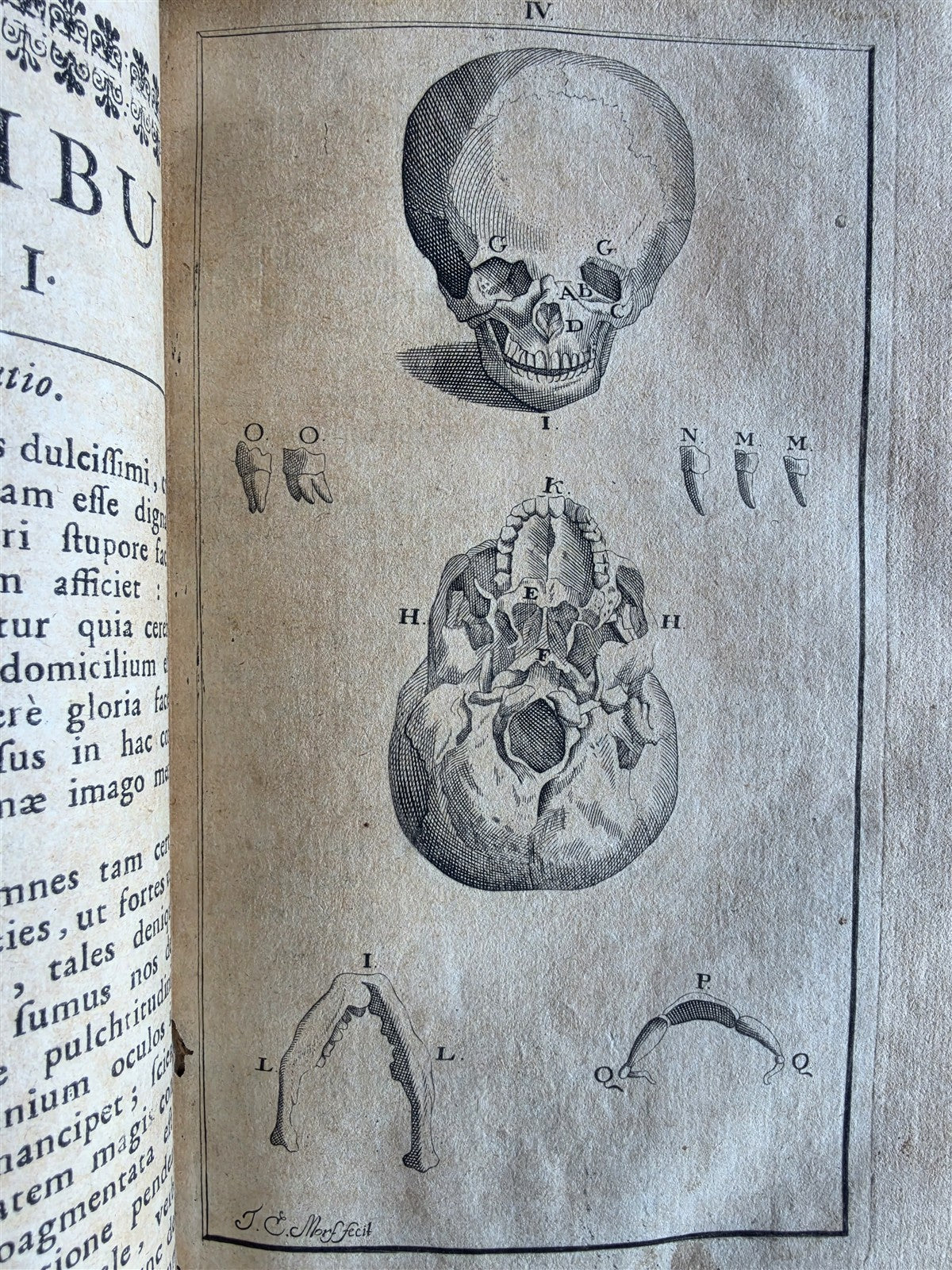 1696 ANATOMICAL TREATISE Anatomia Corporis Humani P.DIONIS antique ILLUSTRATED