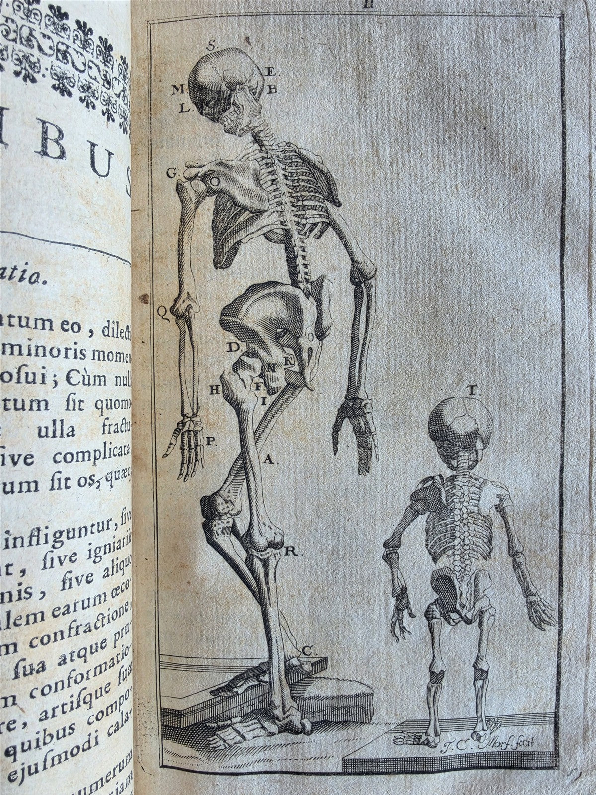 1696 ANATOMICAL TREATISE Anatomia Corporis Humani P.DIONIS antique ILLUSTRATED