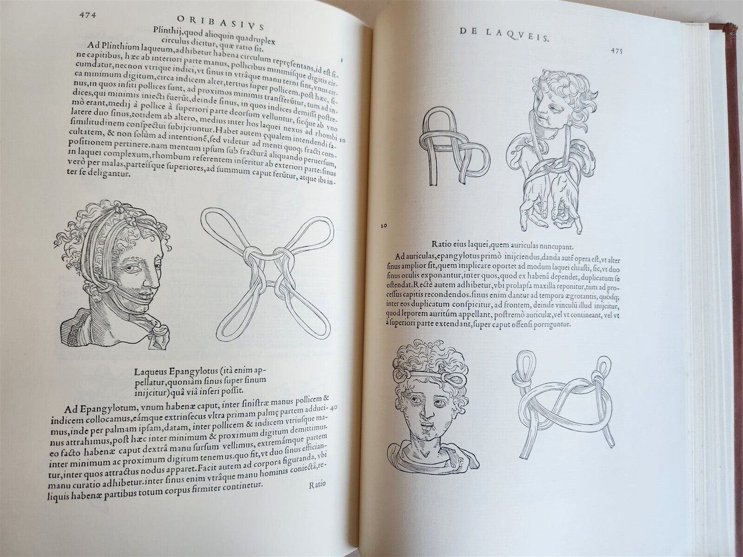 1970 FACSIMILE of Chirurgie a Graeco in Latinum conversa antique ILLUSTRATED