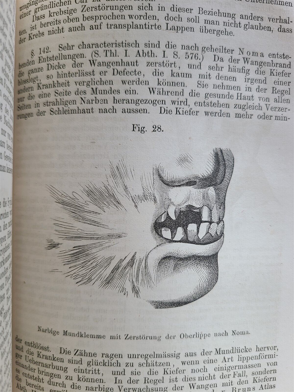 1865-82 SURGERY & ANATOMY 13 volumes FULLY ILLUSTRATED antique in GERMAN