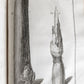 1757 SURGERY ANATOMY ILLUSTRATED antique Memoires l'Academie Royale de Chirurgie