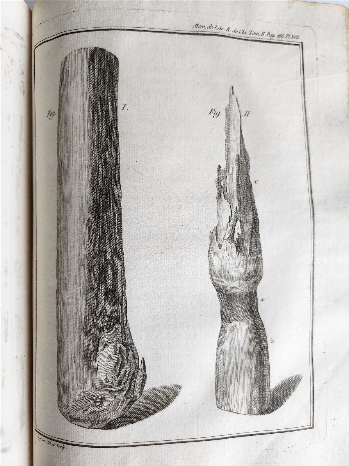 1757 SURGERY ANATOMY ILLUSTRATED antique Memoires l'Academie Royale de Chirurgie