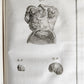 1757 SURGERY ANATOMY ILLUSTRATED antique Memoires l'Academie Royale de Chirurgie