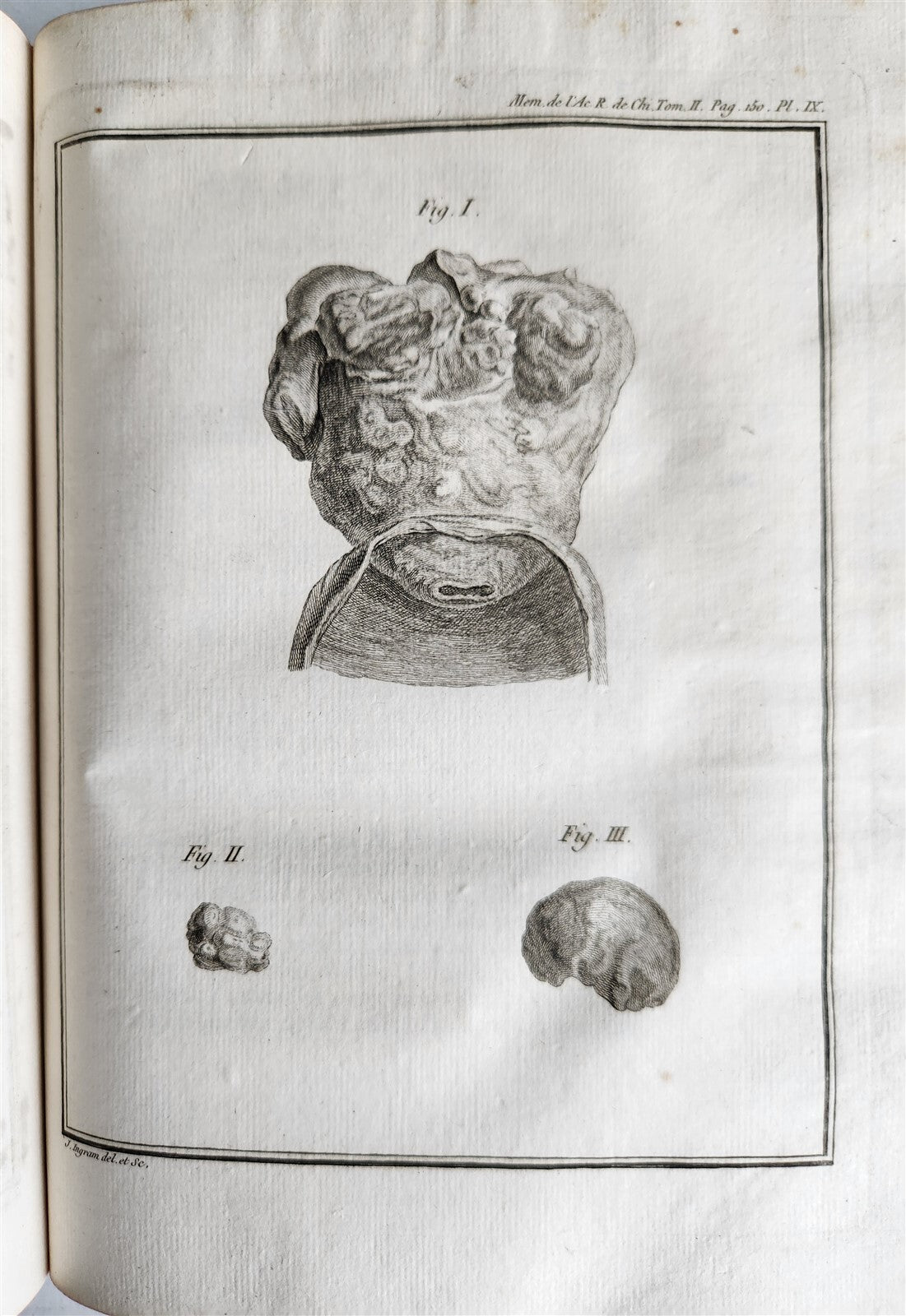 1757 SURGERY ANATOMY ILLUSTRATED antique Memoires l'Academie Royale de Chirurgie