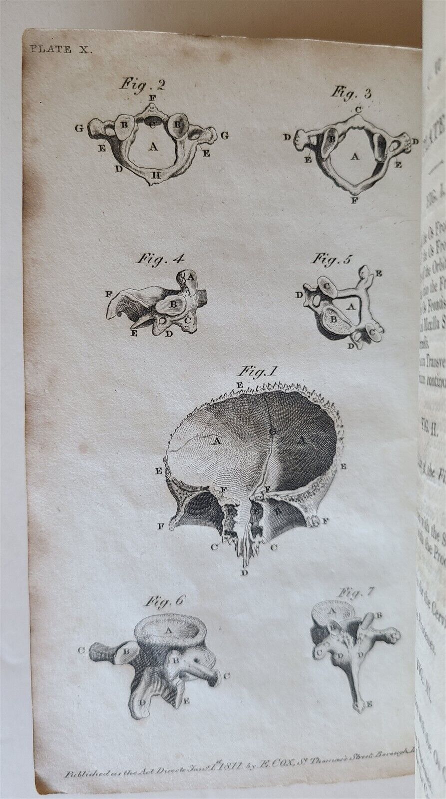 1822 ENGRAVINGS OF THE HUMAN BONES by WILLIAM CHESELDEN ILLUSTRATED antique