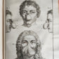 1753 SURGERY ANATOMY ILLUSTRATED antique Memoires l'Academie Royale de Chirurgie