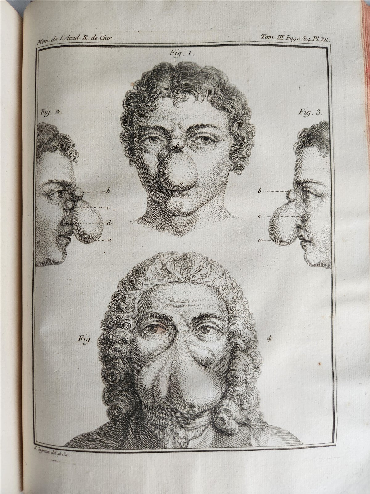 1753 SURGERY ANATOMY ILLUSTRATED antique Memoires l'Academie Royale de Chirurgie