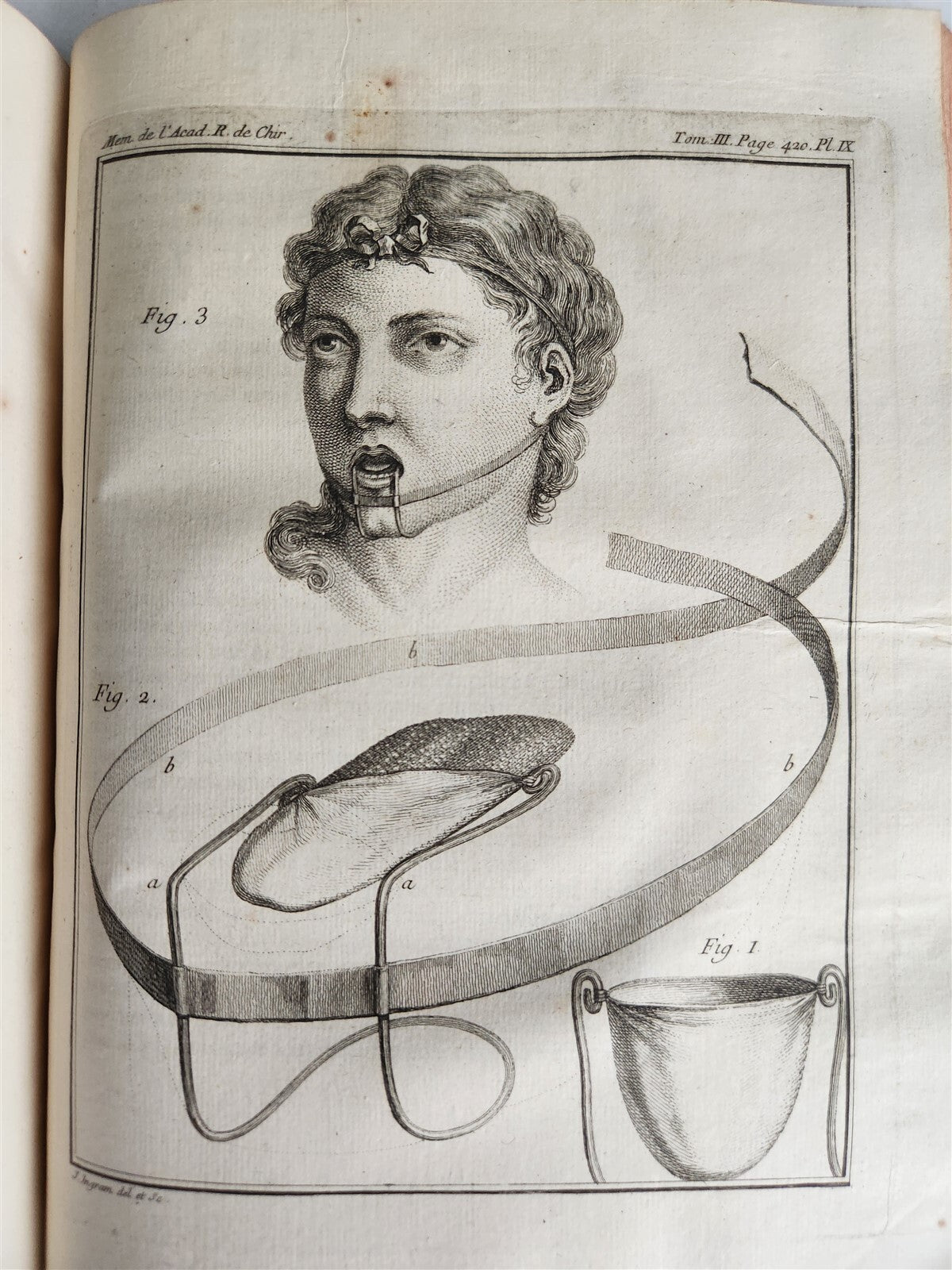 1753 SURGERY ANATOMY ILLUSTRATED antique Memoires l'Academie Royale de Chirurgie