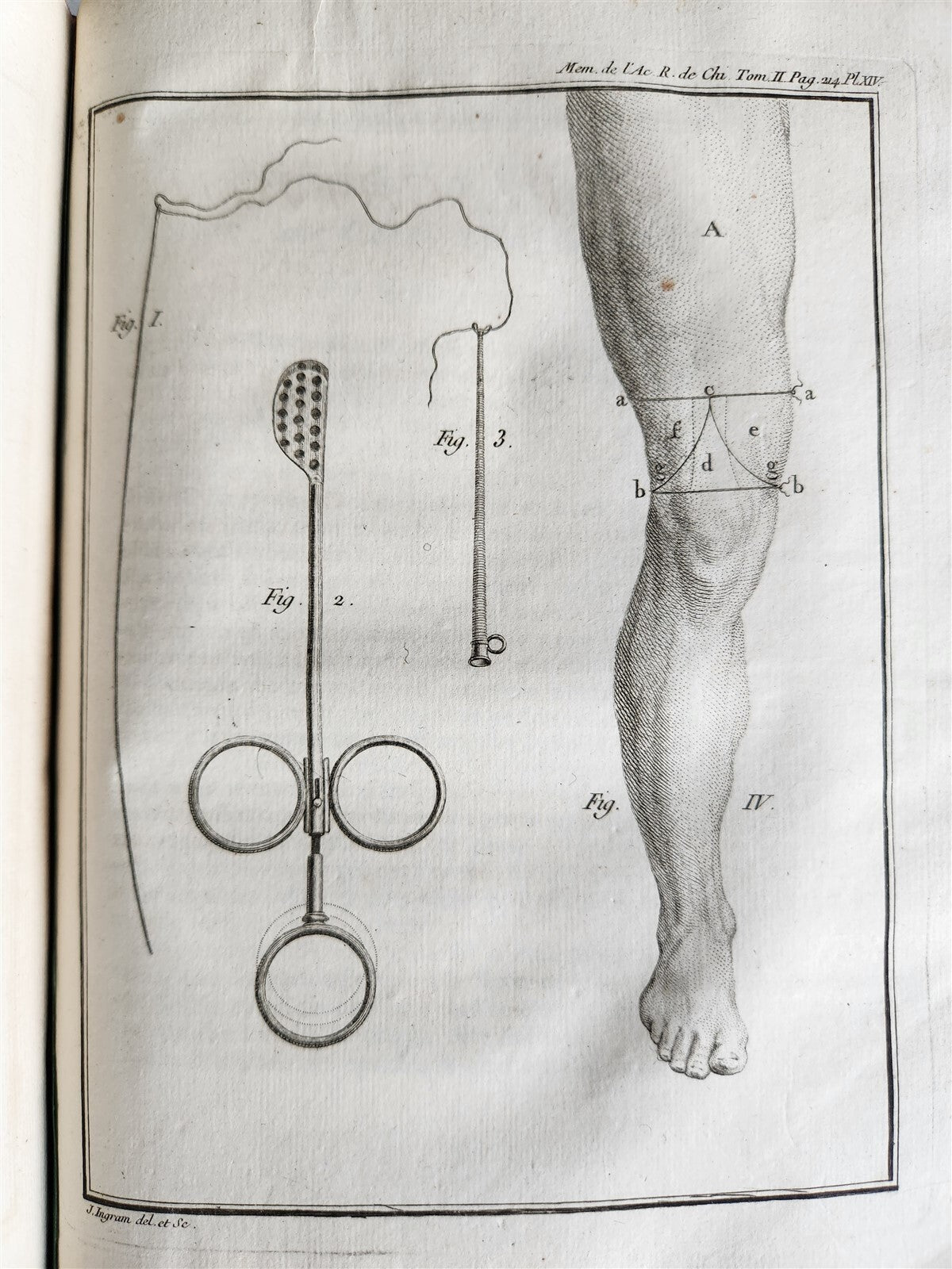 1757 SURGERY ANATOMY ILLUSTRATED antique Memoires l'Academie Royale de Chirurgie