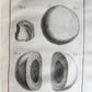 1753 SURGERY ANATOMY ILLUSTRATED antique Memoires l'Academie Royale de Chirurgie