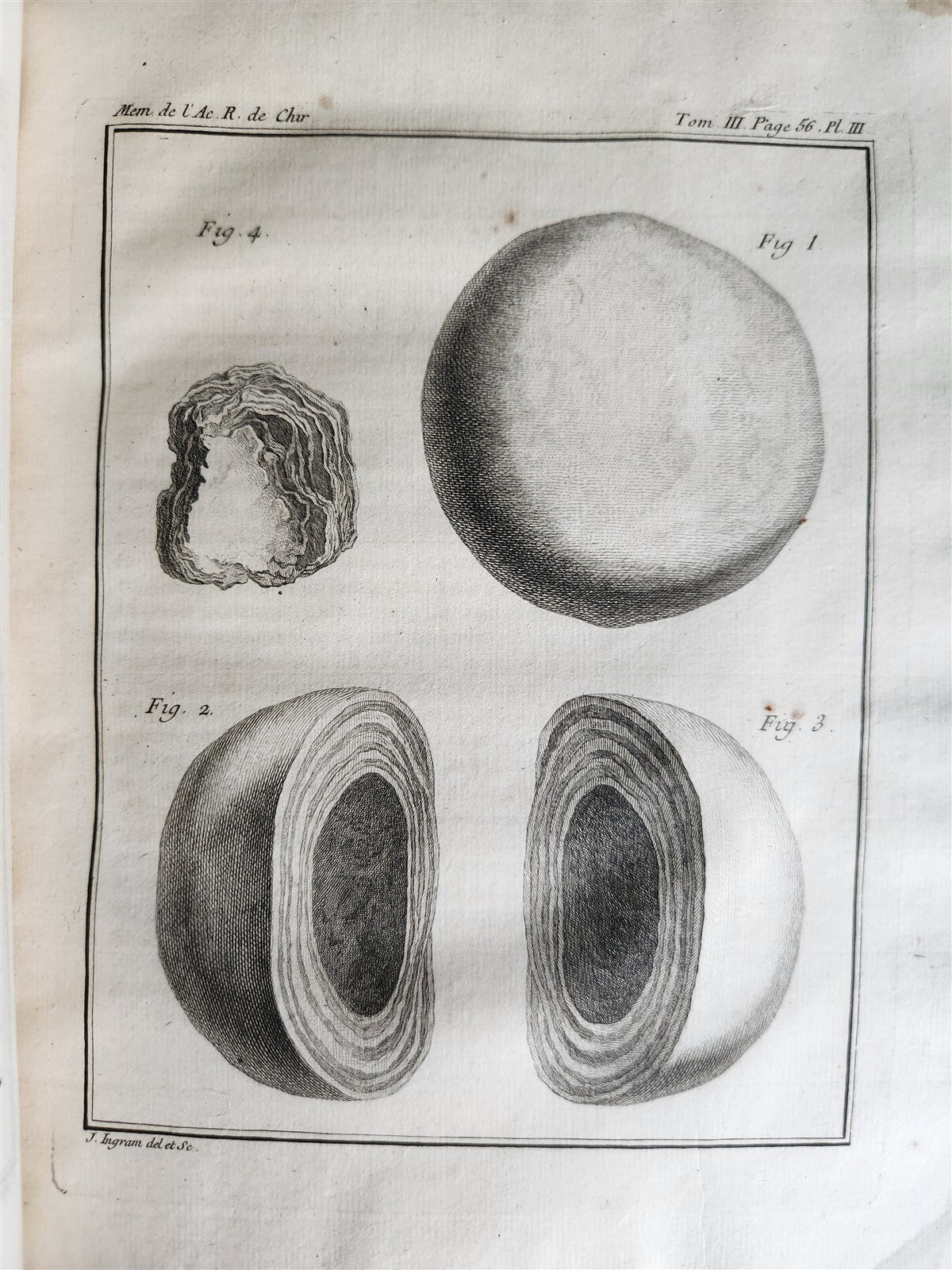 1753 SURGERY ANATOMY ILLUSTRATED antique Memoires l'Academie Royale de Chirurgie