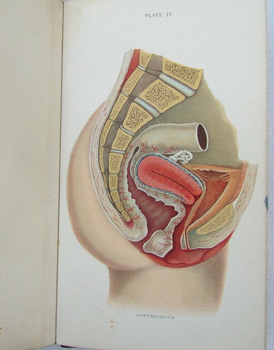 1909 GYNECOLOGICAL PLATES antique leather bound