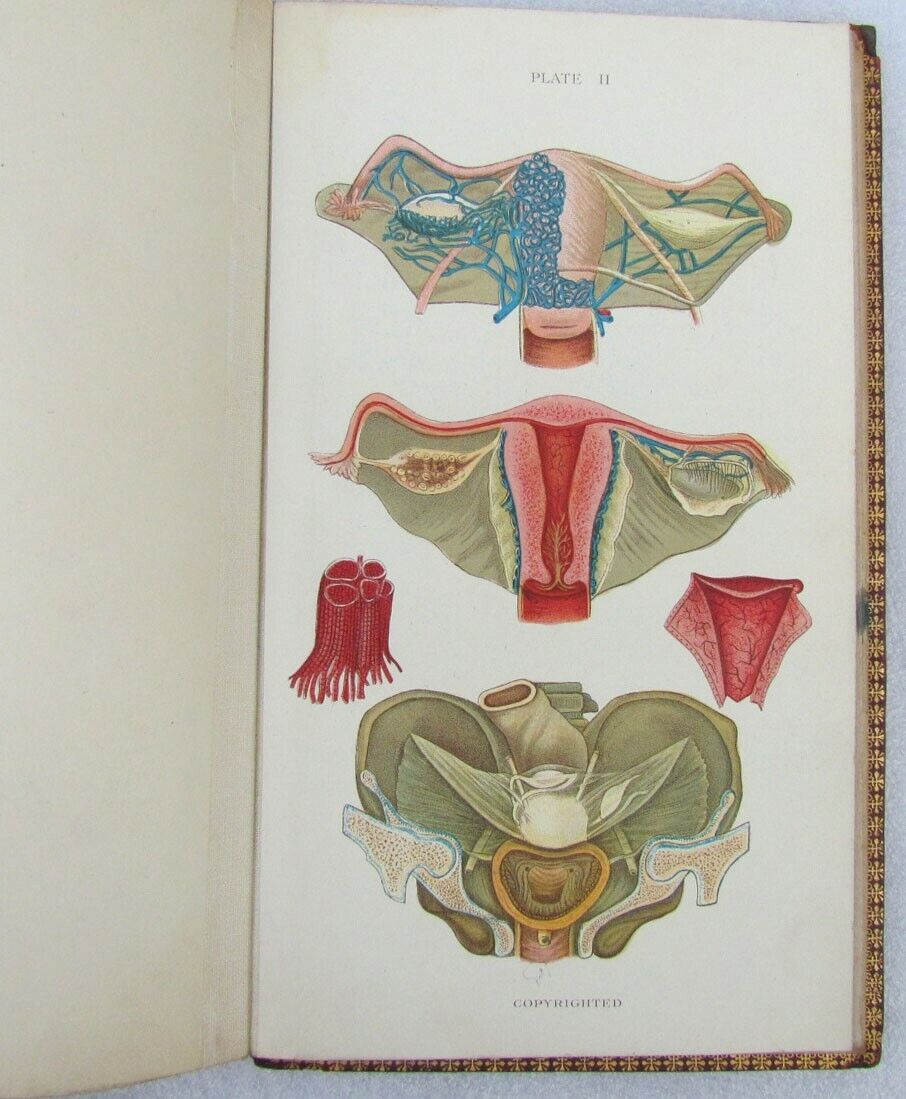 1909 GYNECOLOGICAL PLATES antique leather bound