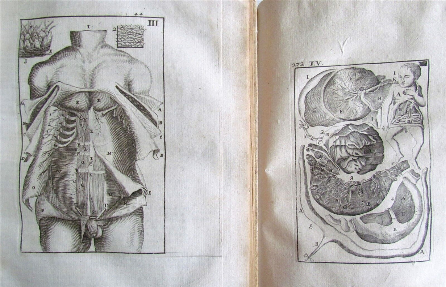 1717 2 VOLUMES ANATOMY ILLUSTRATED CORPORIS HUMANI ANATOMIAE antique in LATIN