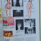 CIBA COLLECTION of MEDICAL ILLUSTRATIONS by FRANK H. NETTER reference & art book