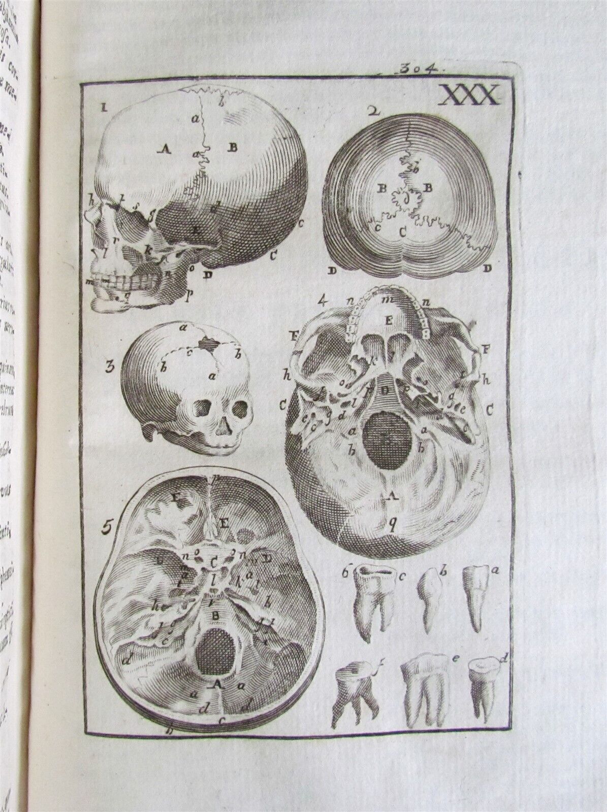 1717 2 VOLUMES ANATOMY ILLUSTRATED CORPORIS HUMANI ANATOMIAE antique in LATIN