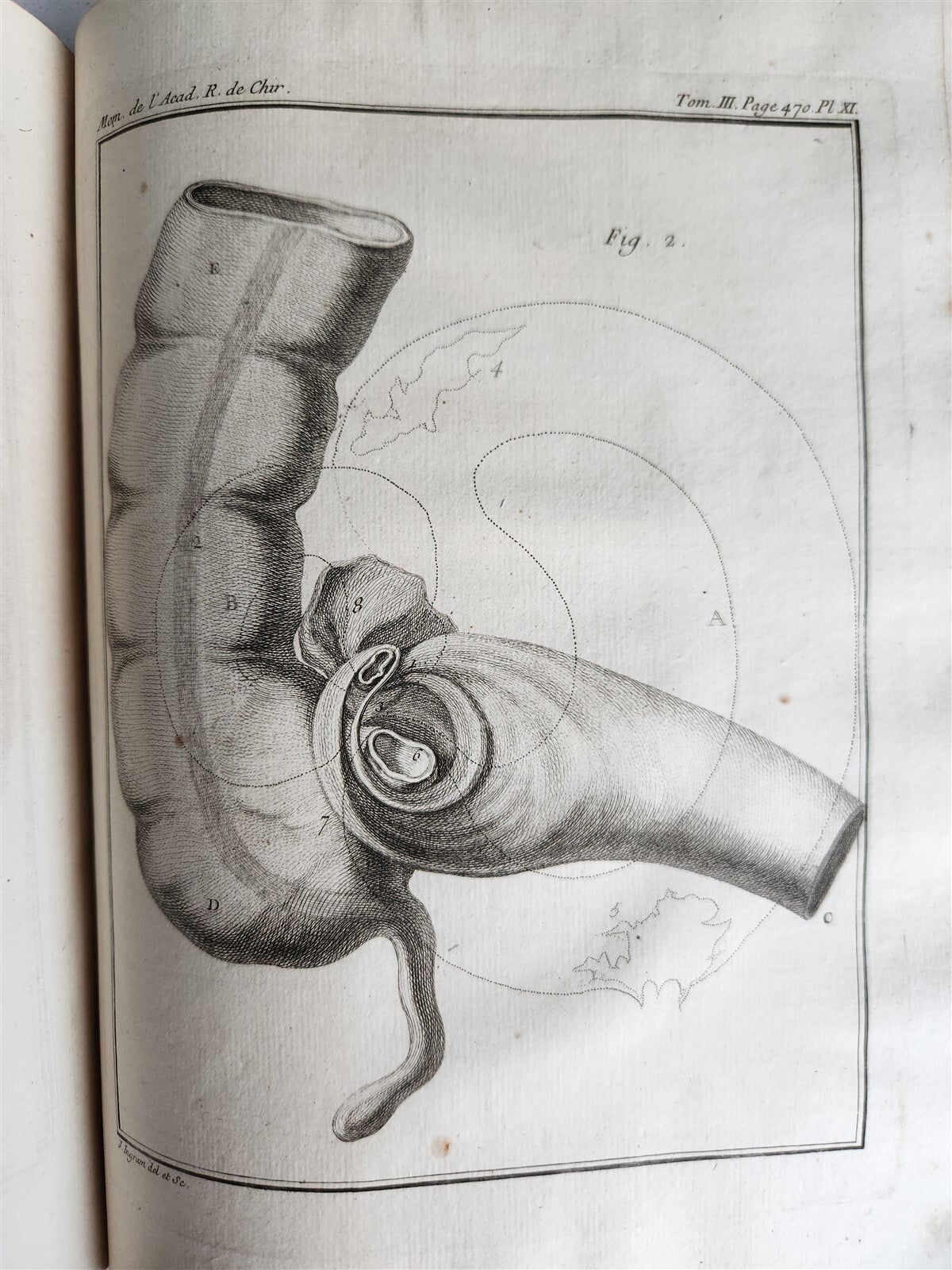 1753 SURGERY ANATOMY ILLUSTRATED antique Memoires l'Academie Royale de Chirurgie