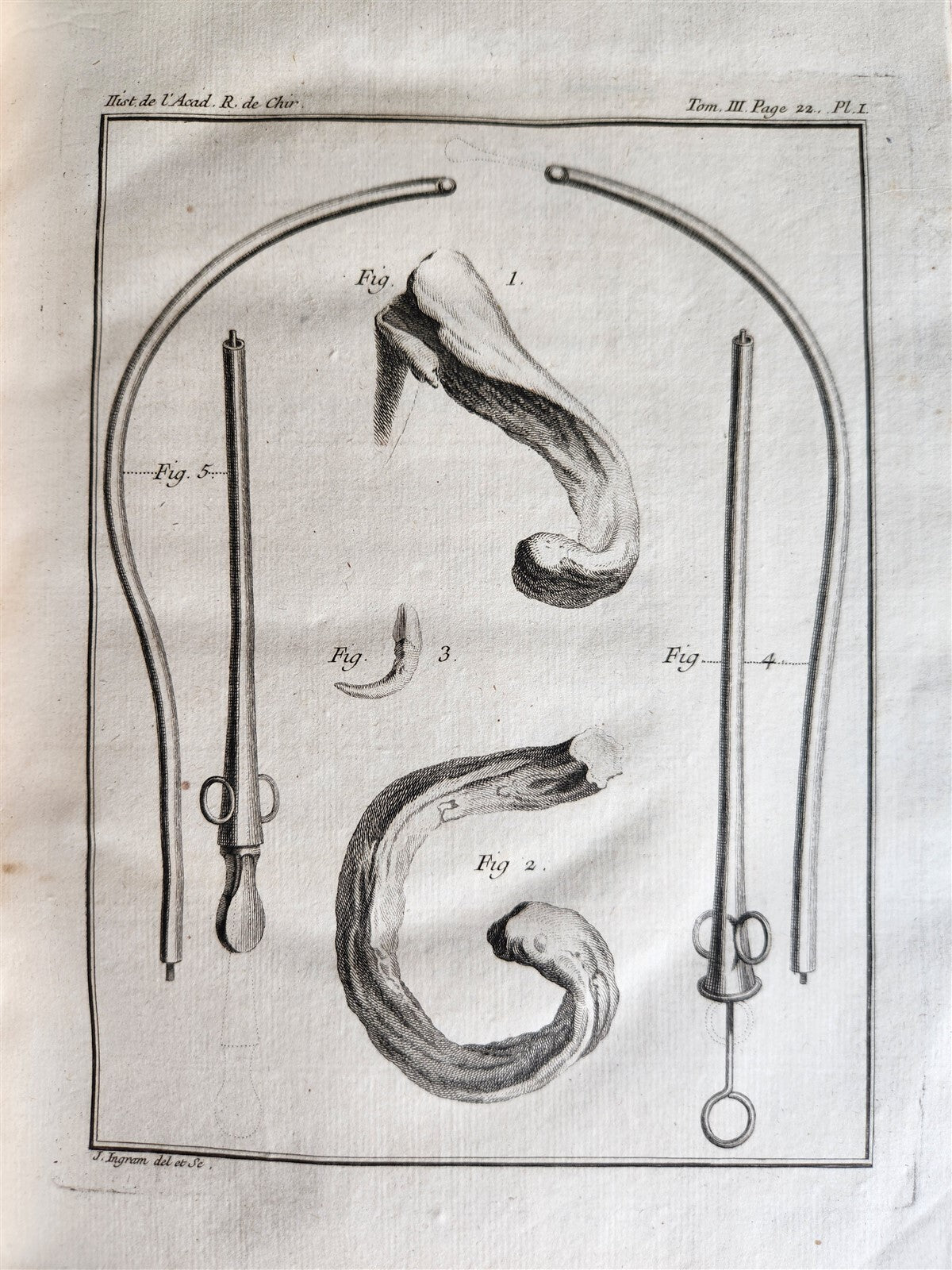 1753 SURGERY ANATOMY ILLUSTRATED antique Memoires l'Academie Royale de Chirurgie