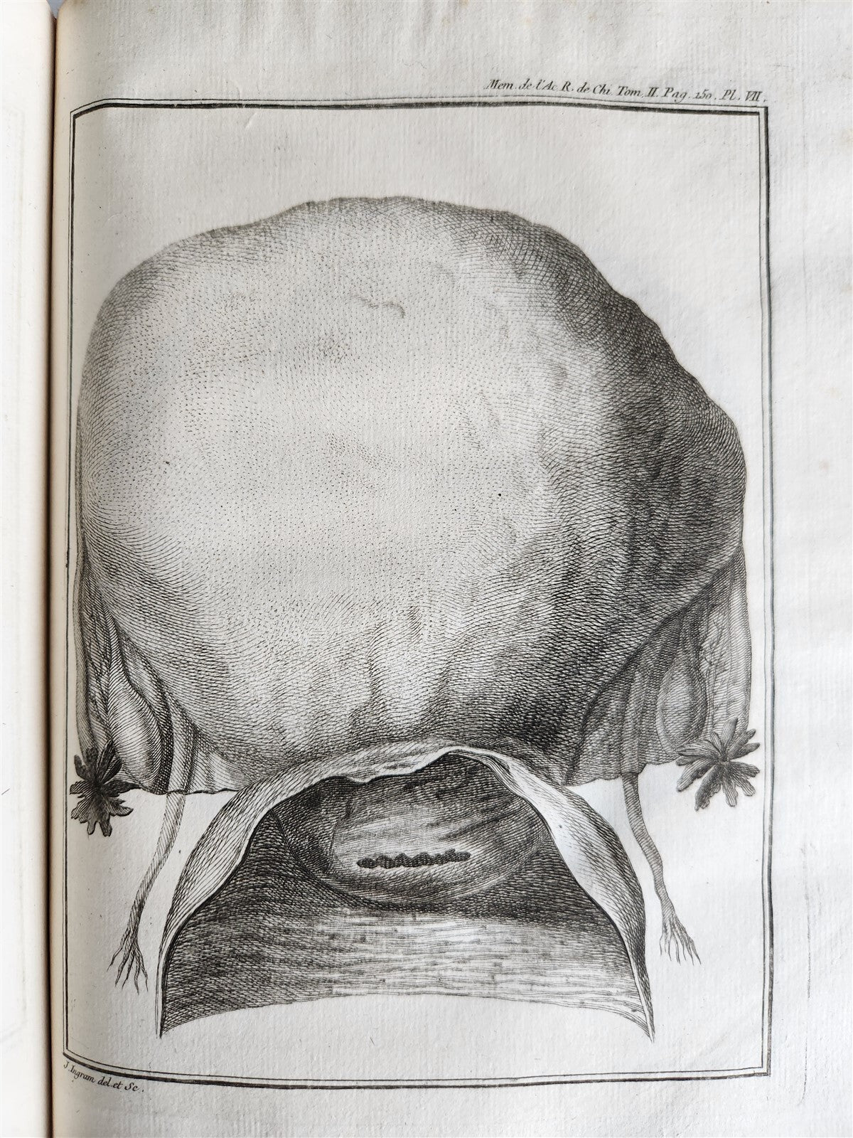 1757 SURGERY ANATOMY ILLUSTRATED antique Memoires l'Academie Royale de Chirurgie