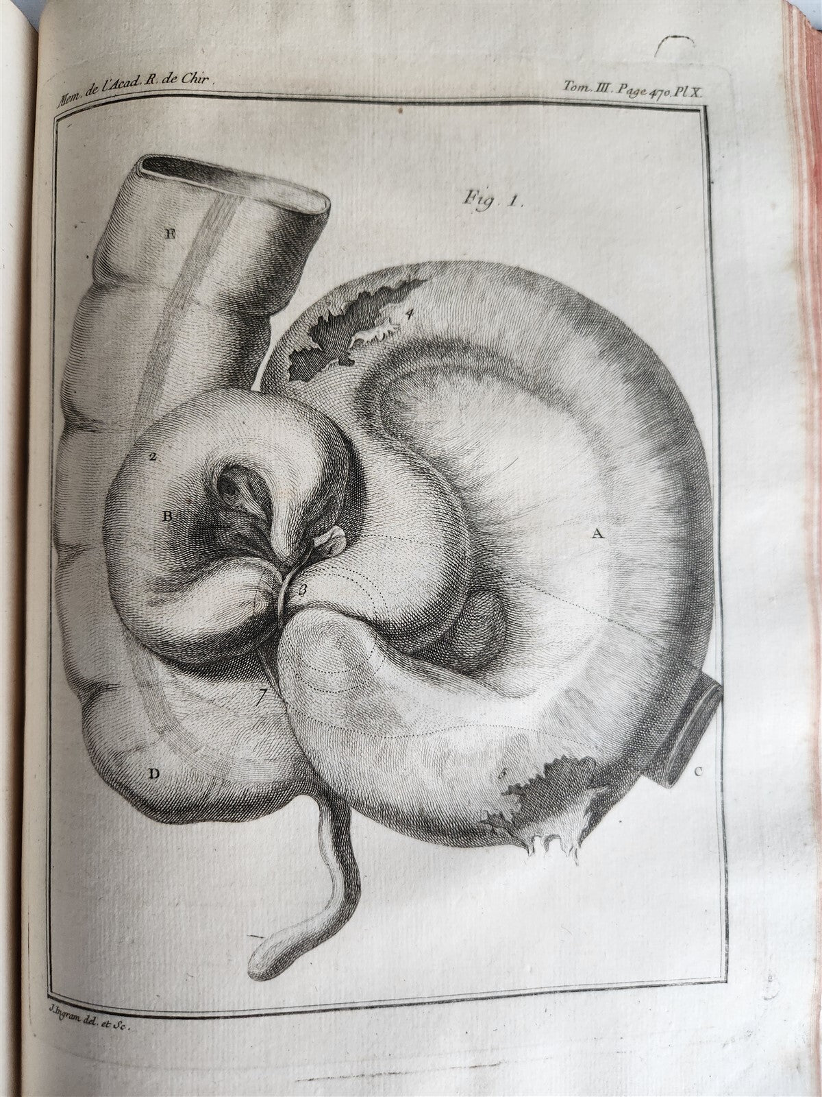 1753 SURGERY ANATOMY ILLUSTRATED antique Memoires l'Academie Royale de Chirurgie