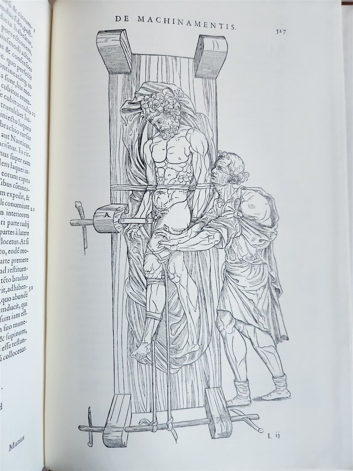 1970 FACSIMILE of Chirurgie a Graeco in Latinum conversa antique ILLUSTRATED