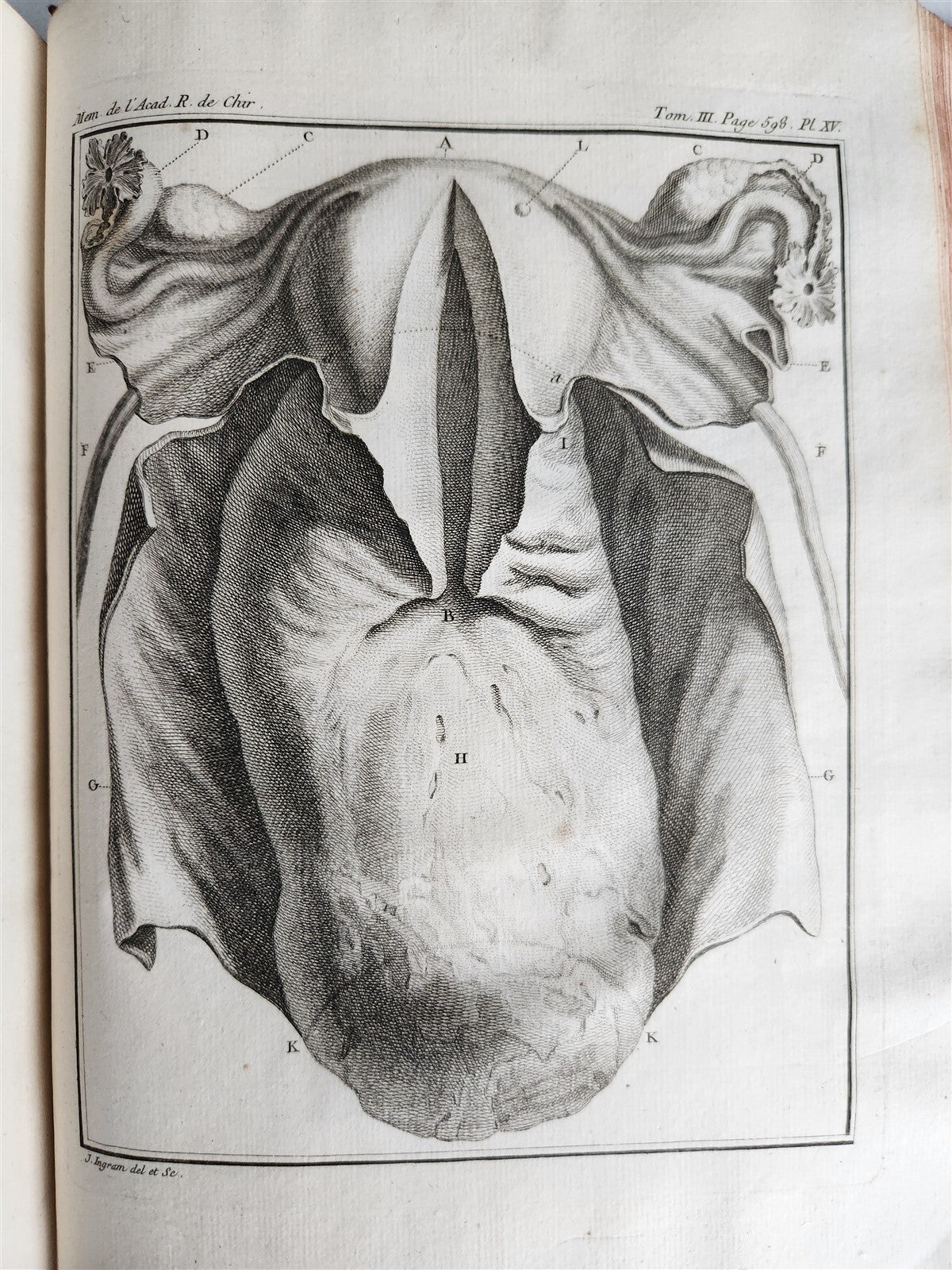 1753 SURGERY ANATOMY ILLUSTRATED antique Memoires l'Academie Royale de Chirurgie