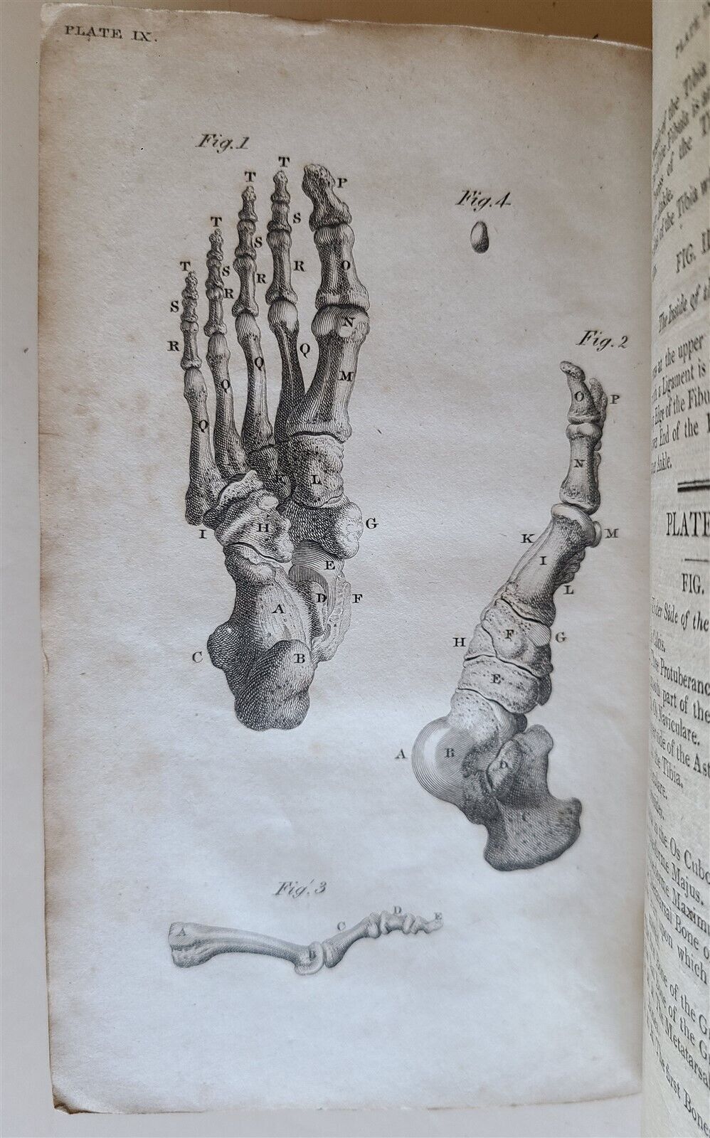 1822 ENGRAVINGS OF THE HUMAN BONES by WILLIAM CHESELDEN ILLUSTRATED antique