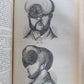 1865-82 SURGERY & ANATOMY 13 volumes FULLY ILLUSTRATED antique in GERMAN