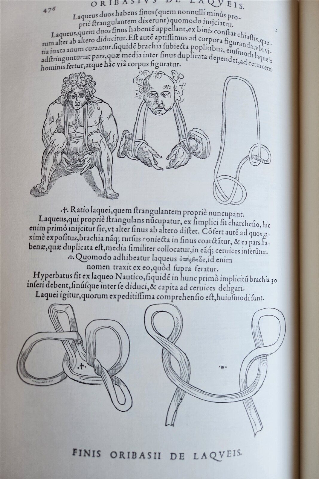 1970 FACSIMILE of Chirurgie a Graeco in Latinum conversa antique ILLUSTRATED