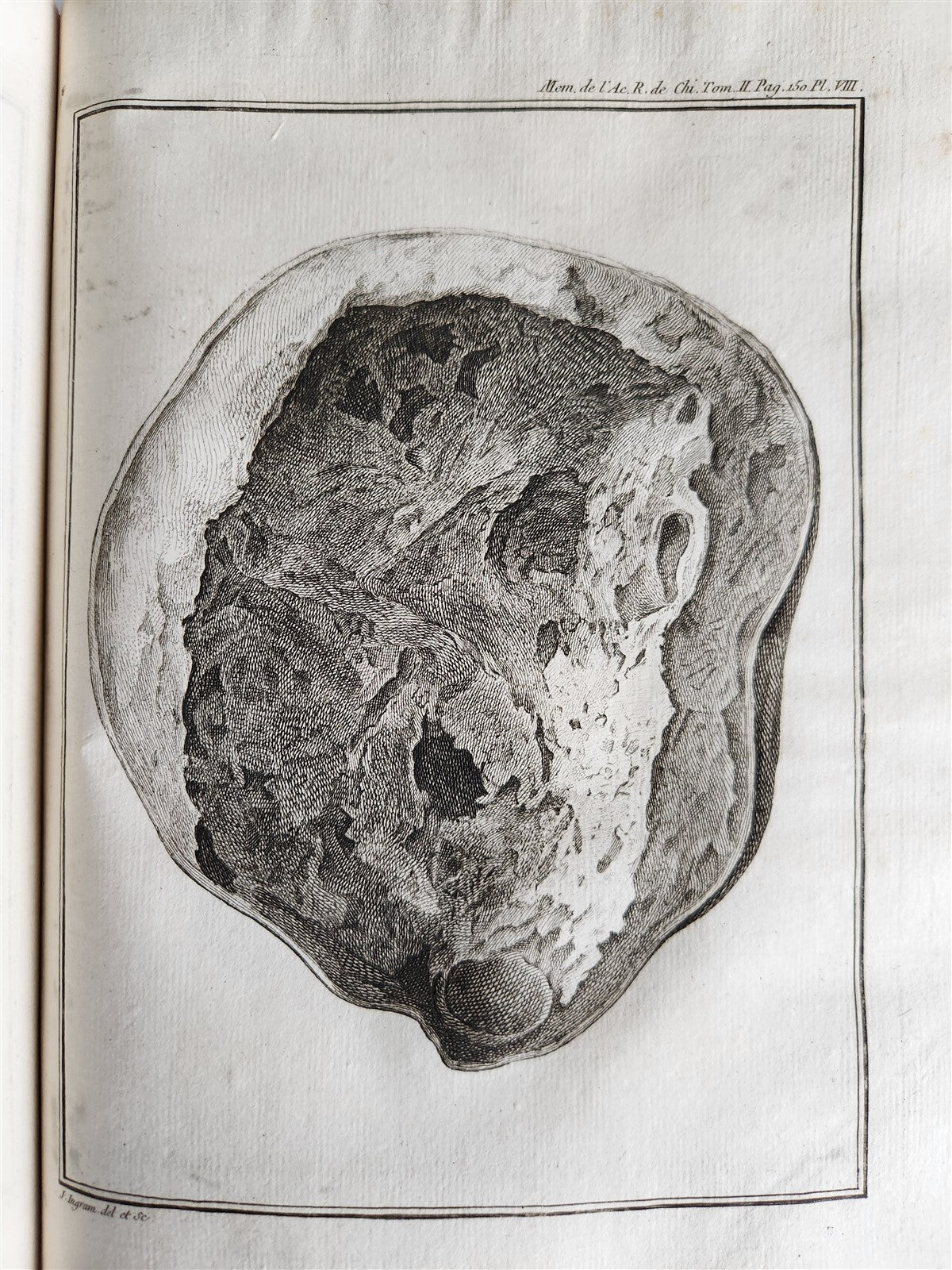 1757 SURGERY ANATOMY ILLUSTRATED antique Memoires l'Academie Royale de Chirurgie