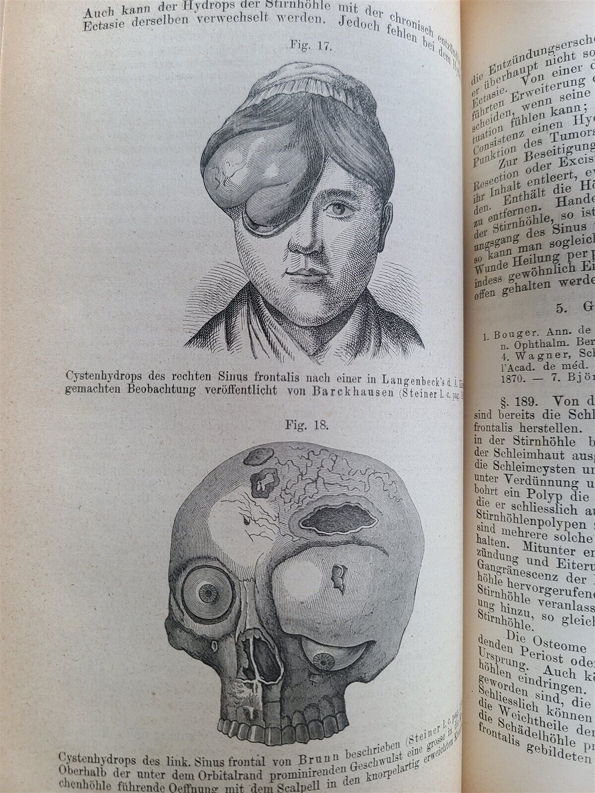 1865-82 SURGERY & ANATOMY 13 volumes FULLY ILLUSTRATED antique in GERMAN