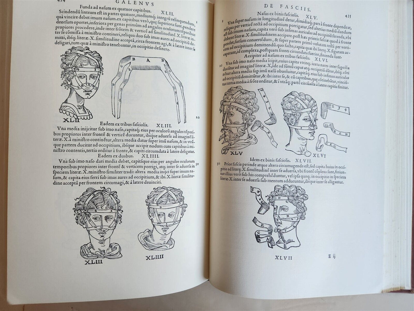 1970 FACSIMILE of Chirurgie a Graeco in Latinum conversa antique ILLUSTRATED
