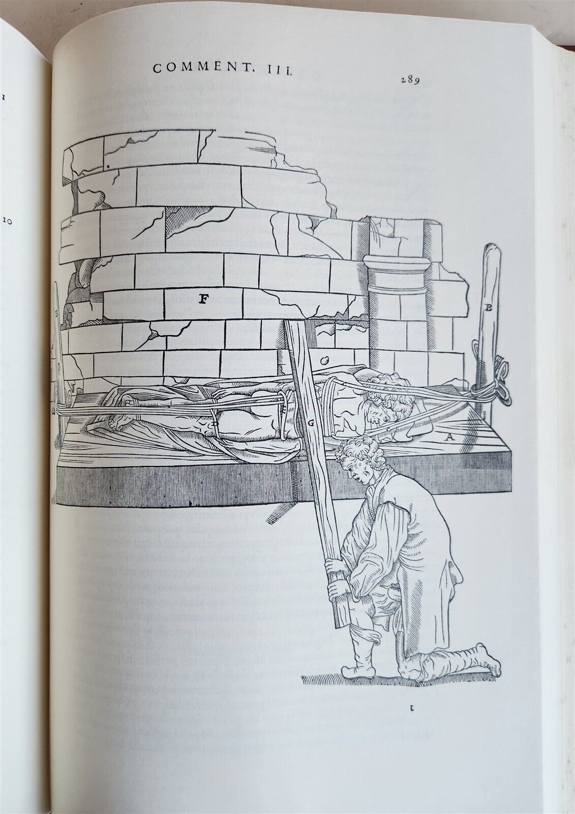 1970 FACSIMILE of Chirurgie a Graeco in Latinum conversa antique ILLUSTRATED