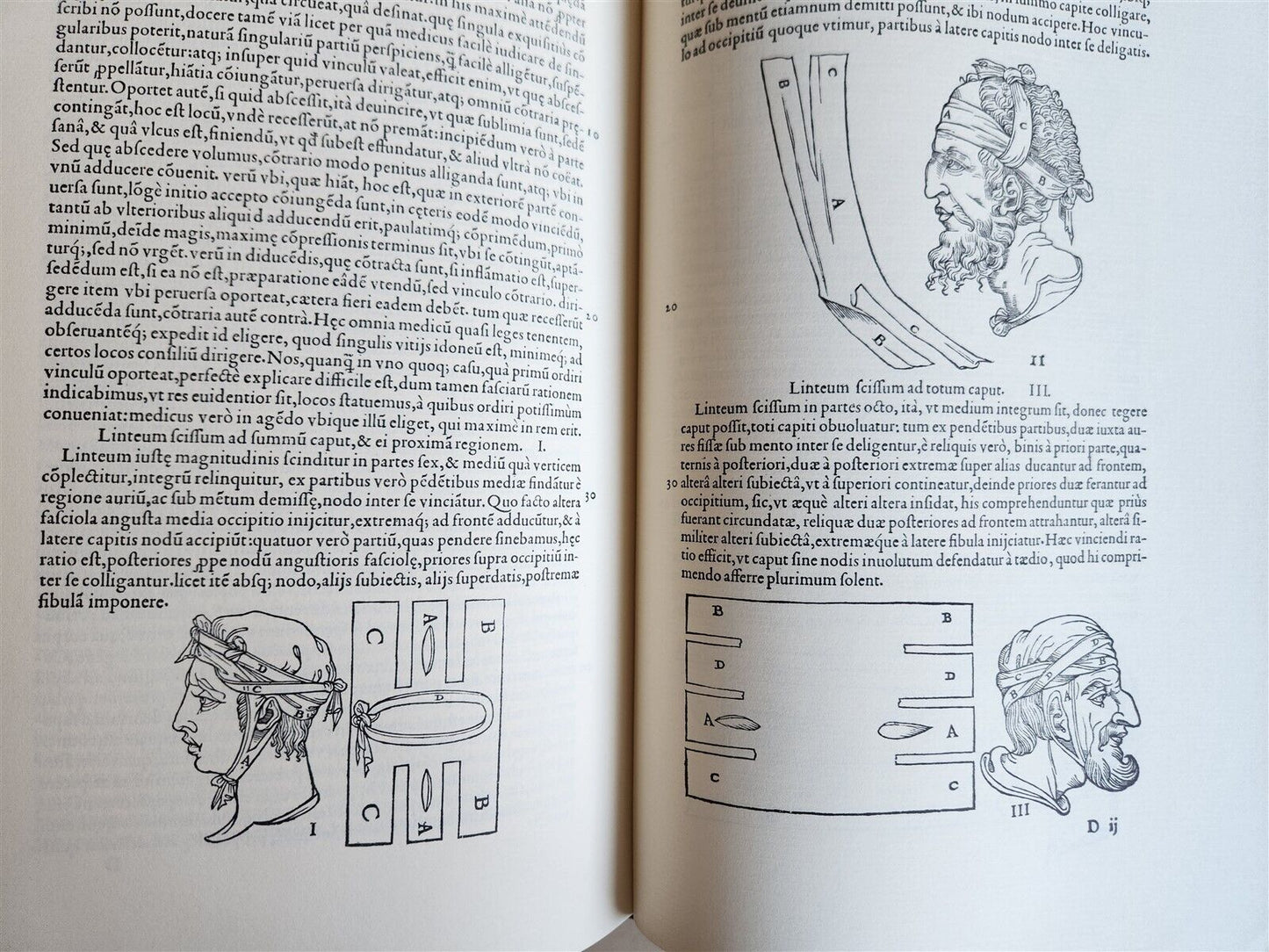 1970 FACSIMILE of Chirurgie a Graeco in Latinum conversa antique ILLUSTRATED
