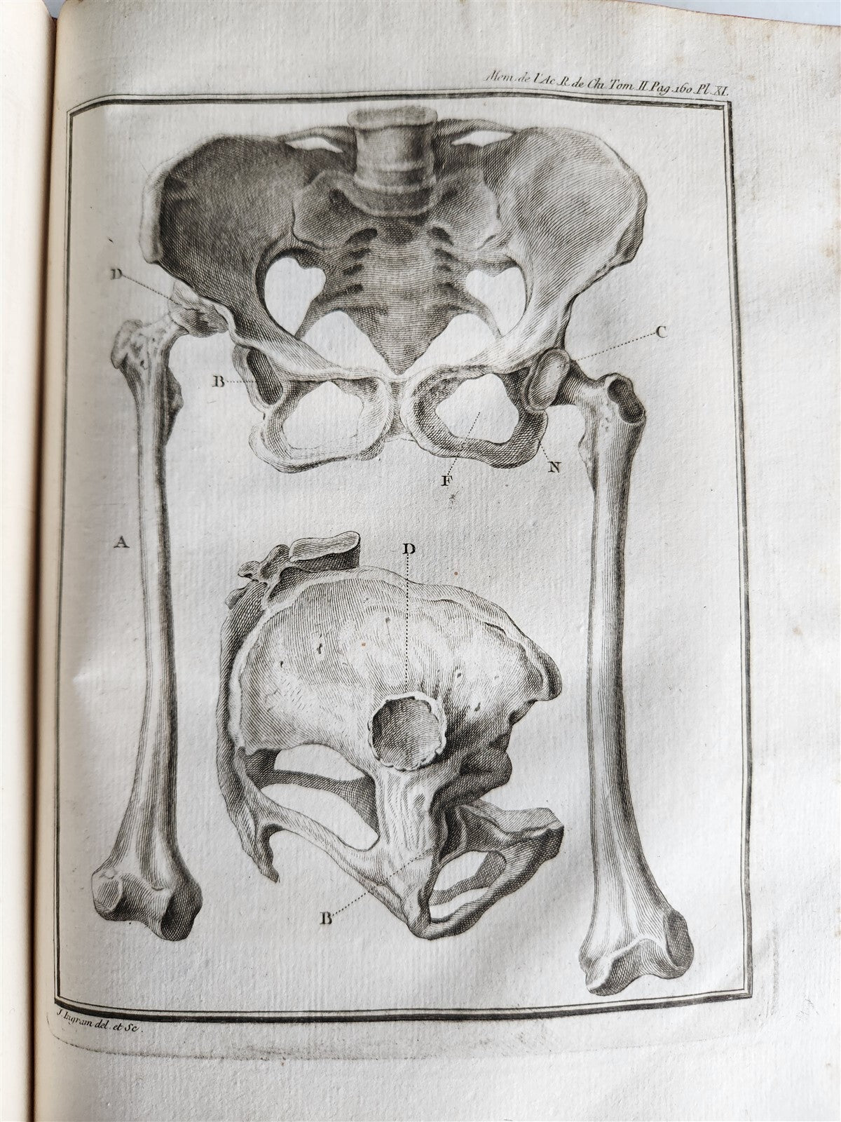 1757 SURGERY ANATOMY ILLUSTRATED antique Memoires l'Academie Royale de Chirurgie
