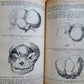 1865-82 SURGERY & ANATOMY 13 volumes FULLY ILLUSTRATED antique in GERMAN