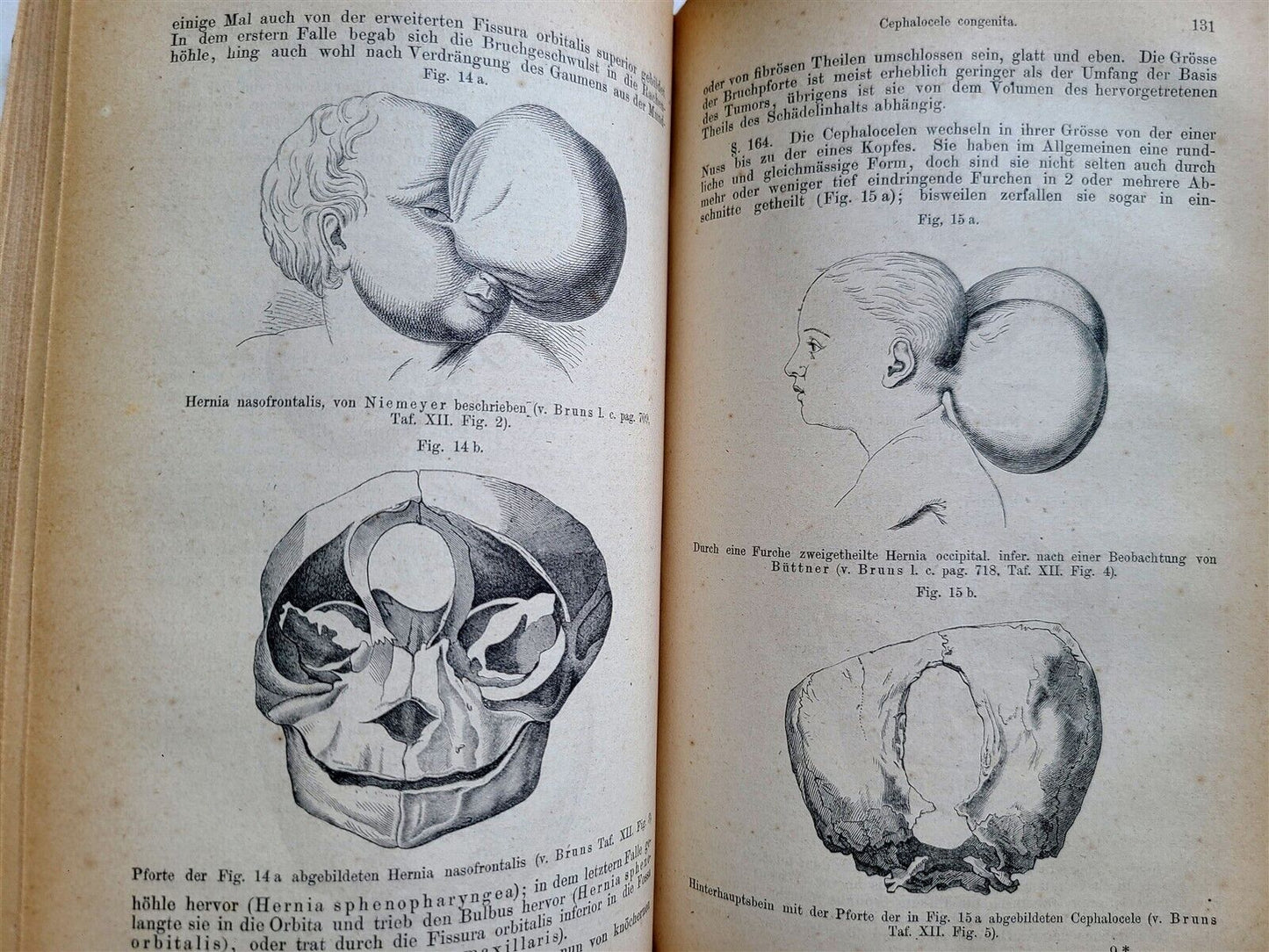 1865-82 SURGERY & ANATOMY 13 volumes FULLY ILLUSTRATED antique in GERMAN