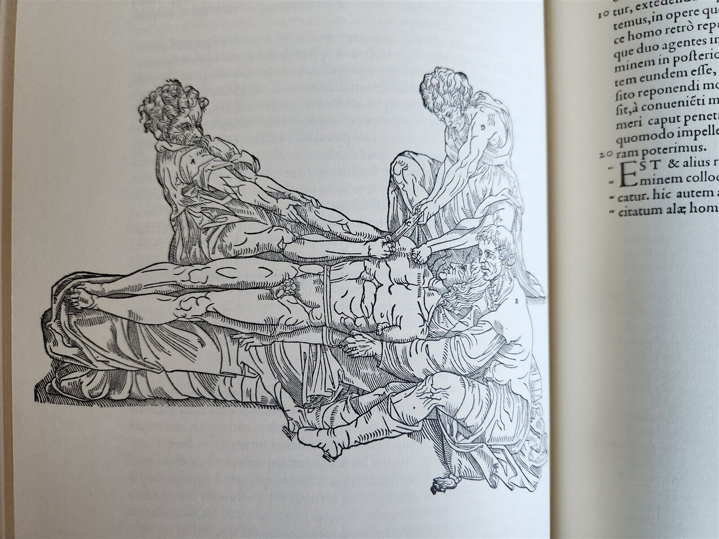 1970 FACSIMILE of Chirurgie a Graeco in Latinum conversa antique ILLUSTRATED
