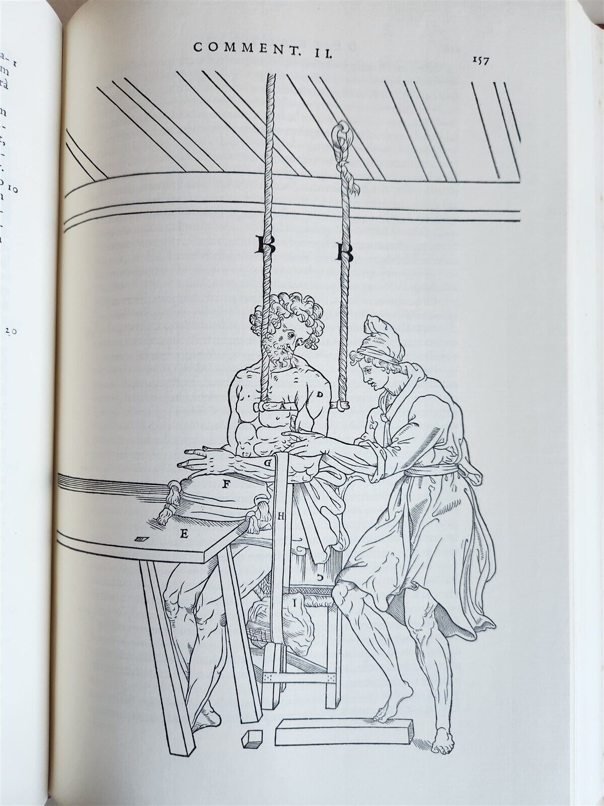1970 FACSIMILE of Chirurgie a Graeco in Latinum conversa antique ILLUSTRATED