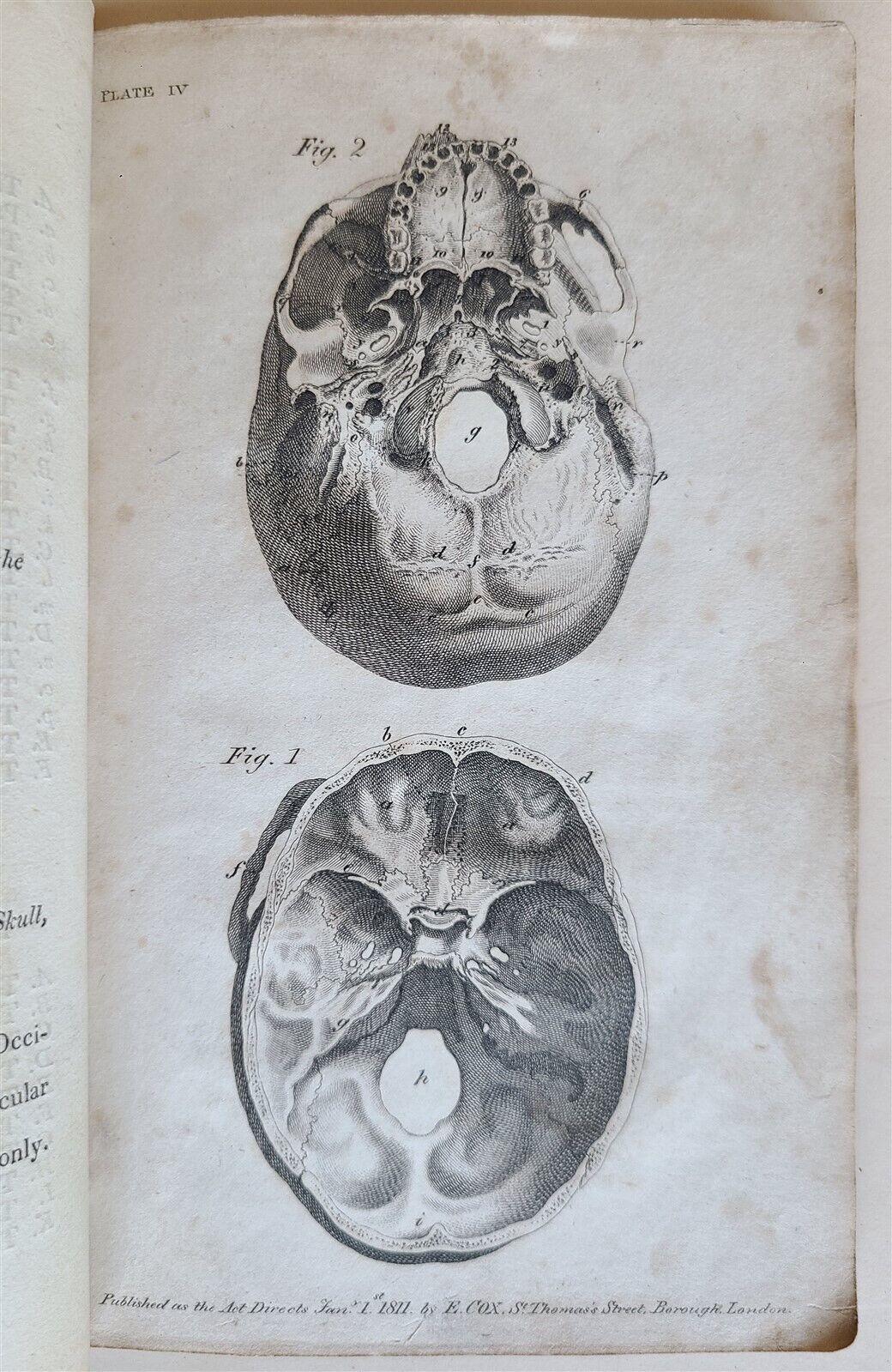 1822 ENGRAVINGS OF THE HUMAN BONES by WILLIAM CHESELDEN ILLUSTRATED antique