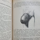 1865-82 SURGERY & ANATOMY 13 volumes FULLY ILLUSTRATED antique in GERMAN