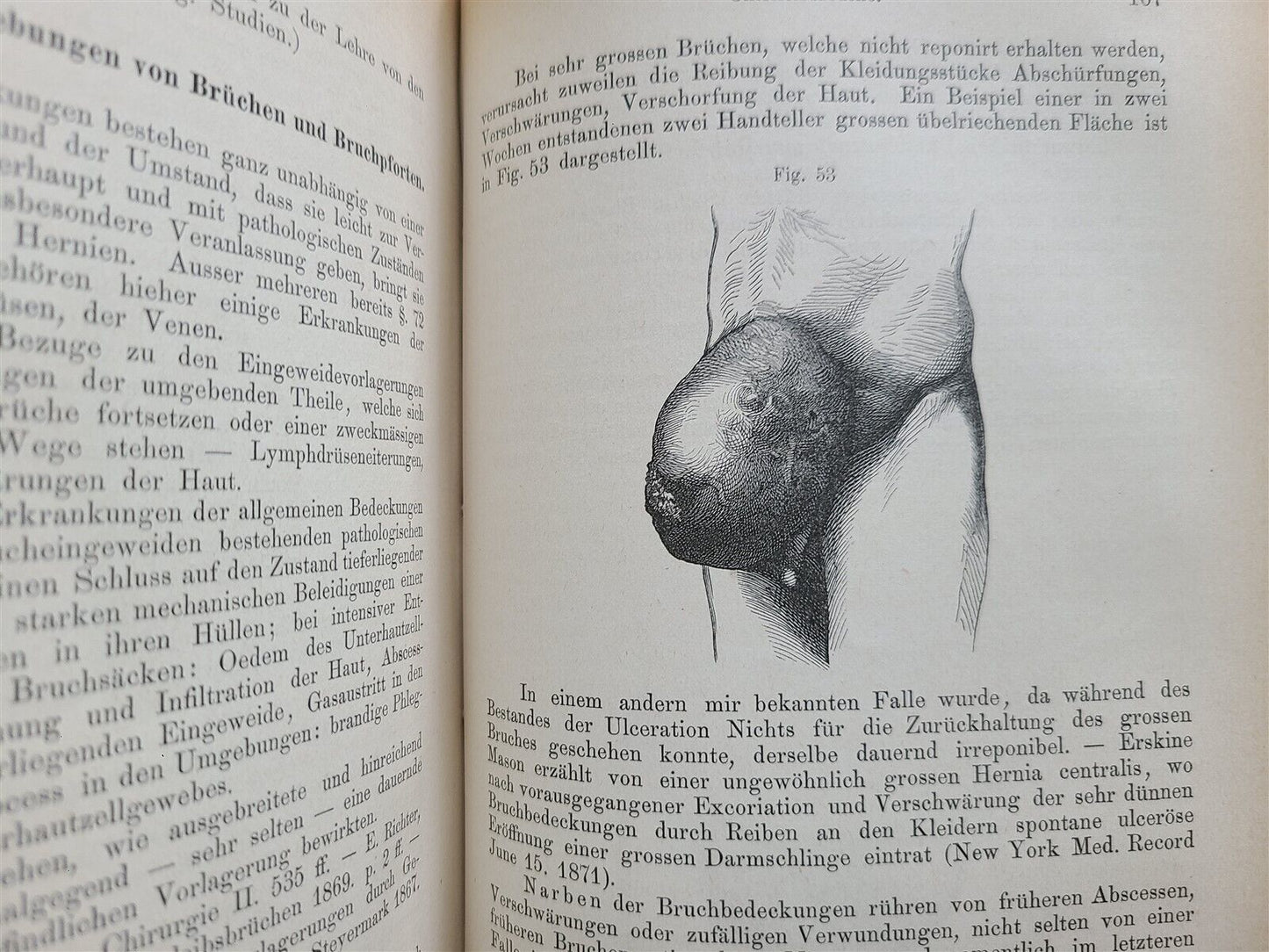 1865-82 SURGERY & ANATOMY 13 volumes FULLY ILLUSTRATED antique in GERMAN