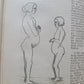 1865-82 SURGERY & ANATOMY 13 volumes FULLY ILLUSTRATED antique in GERMAN