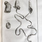1757 SURGERY ANATOMY ILLUSTRATED antique Memoires l'Academie Royale de Chirurgie