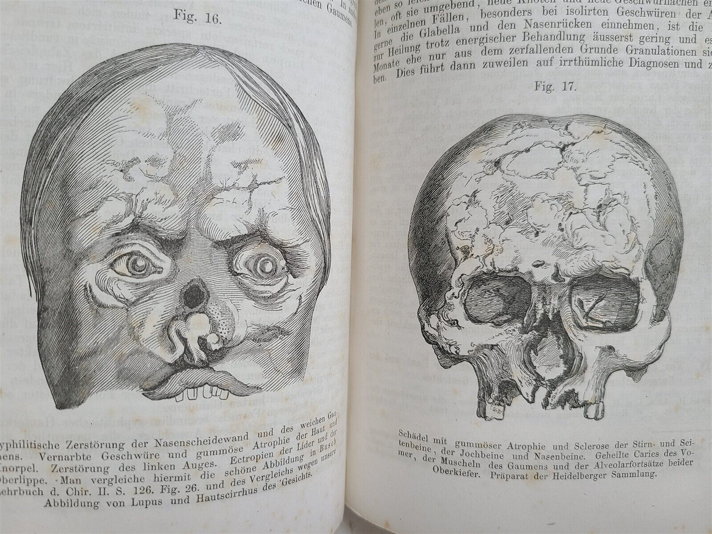 1865-82 SURGERY & ANATOMY 13 volumes FULLY ILLUSTRATED antique in GERMAN