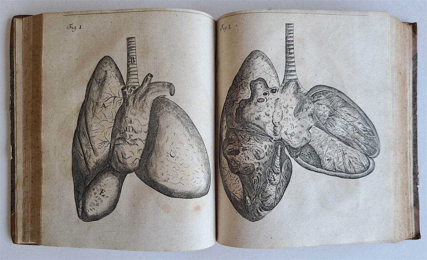 1747-1751 COLLECTION of MEDICAL & SURGICAL NOTES by Henckel ILLUSTRATED antique