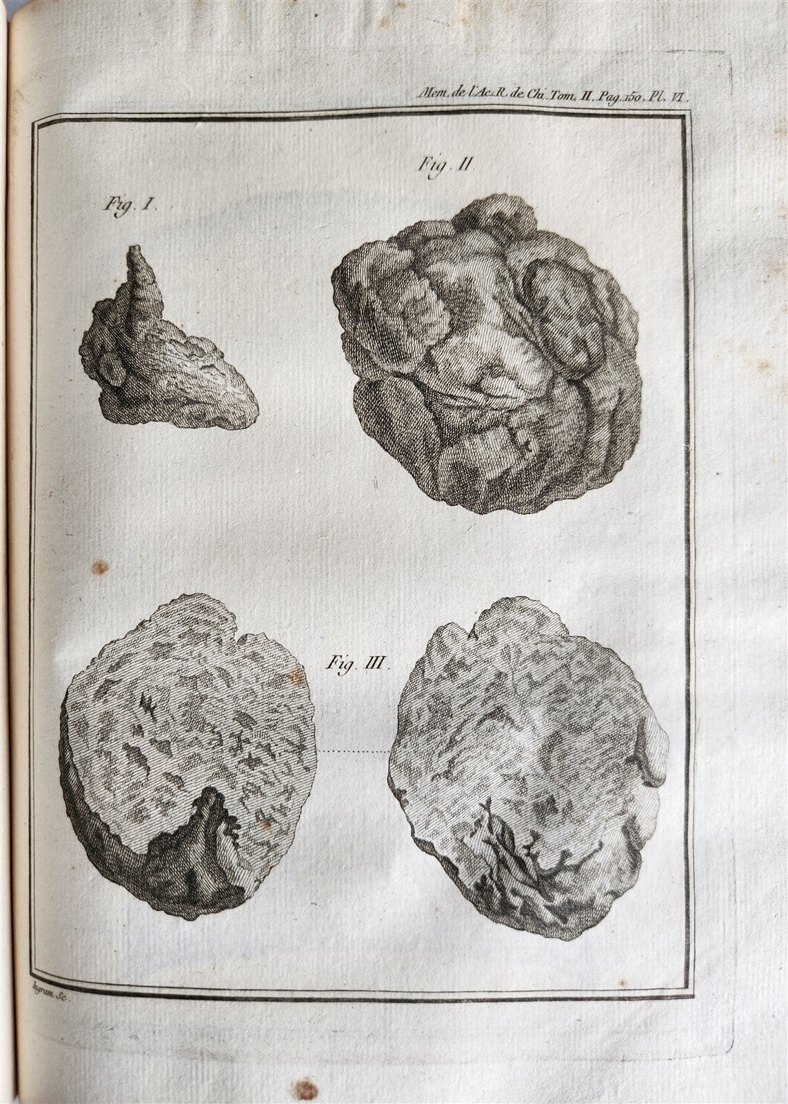 1757 SURGERY ANATOMY ILLUSTRATED antique Memoires l'Academie Royale de Chirurgie